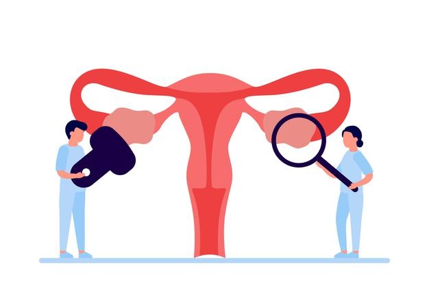 Doctor checkup reproductive system of woman health and disease uterus and ovary internal organ